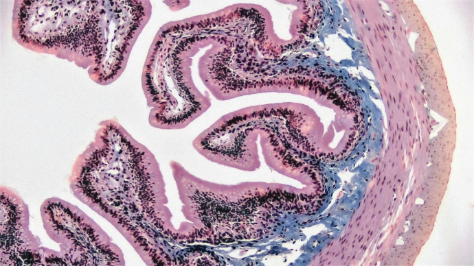 Microscopic view of villi in the digestive tract